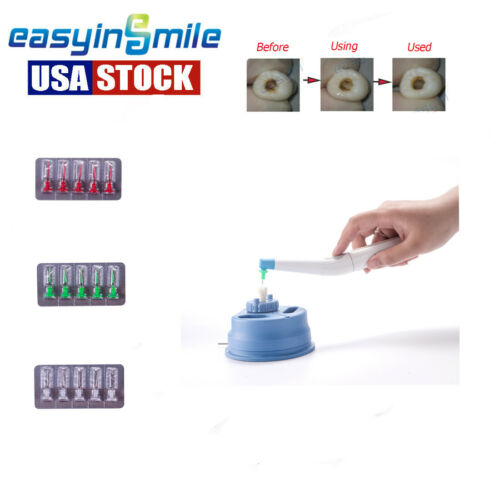 Dental Endo Sonic Activator Irrigator Tips Needle Files Endodontic Cleaning kit